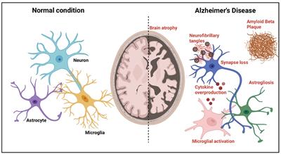 Unravelling the connection between COVID-19 and Alzheimer’s disease: a comprehensive review
